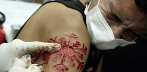 tatuaggio in rilievo