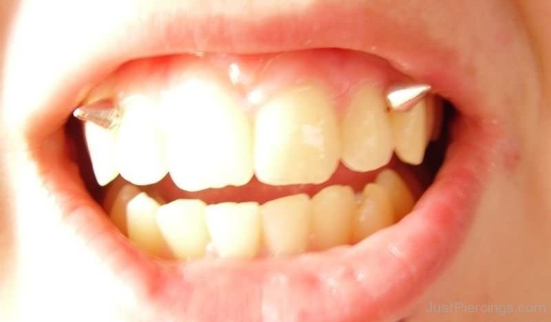 Gum-Piercing-With-Spike-Studs