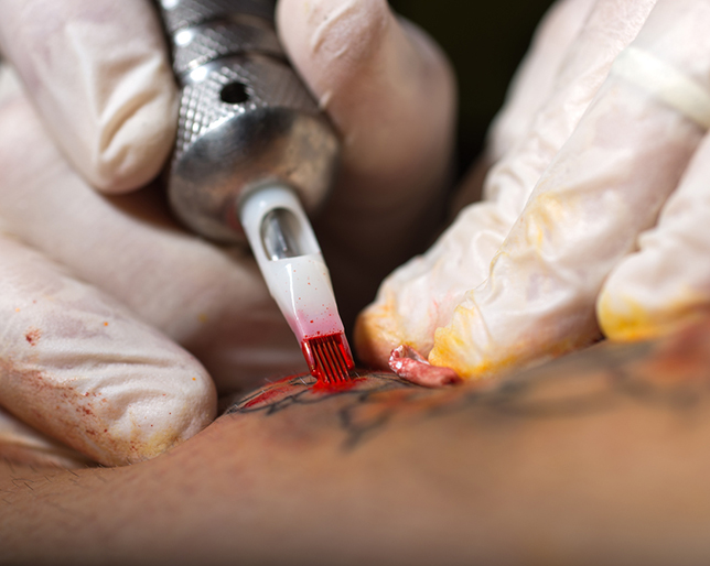 tattoo-complications_0