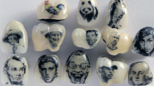 tatuaggio-sui-denti-corone-dentali