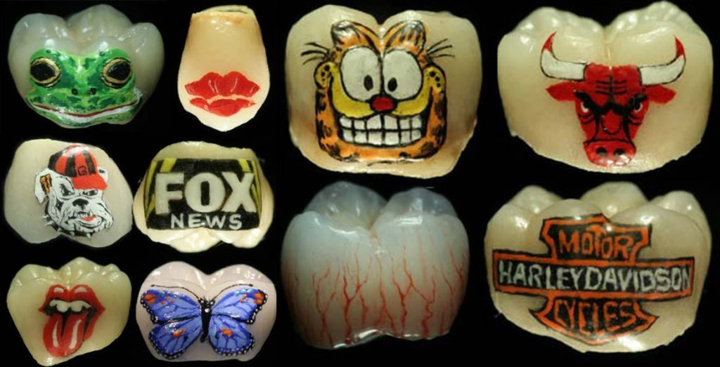 tatuaggio-sui-denti-corone-dentali-colorate
