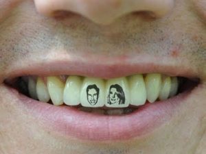 tatuaggio-sui-denti-ritratto