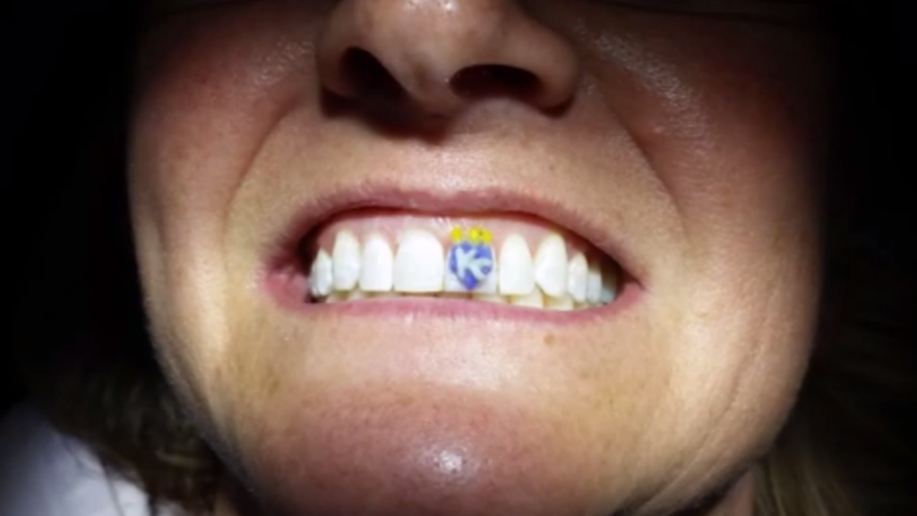 tatuaggio-sui-denti-simbolo