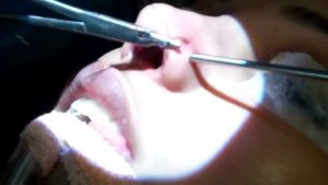 nostril piercing