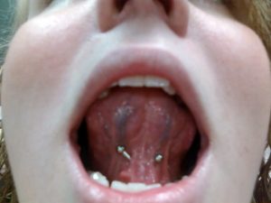 PIERCING
