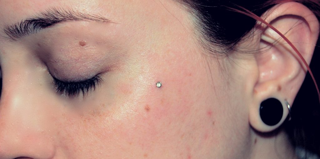 Microdermal